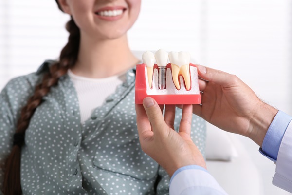 Can A General Dentist Repair A Dental Implant Restoration?