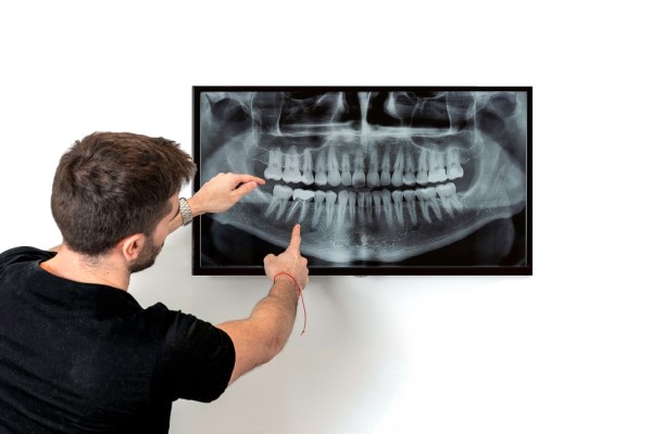 General Dentistry: How A Dentist Uses X Rays In A Dental Exam