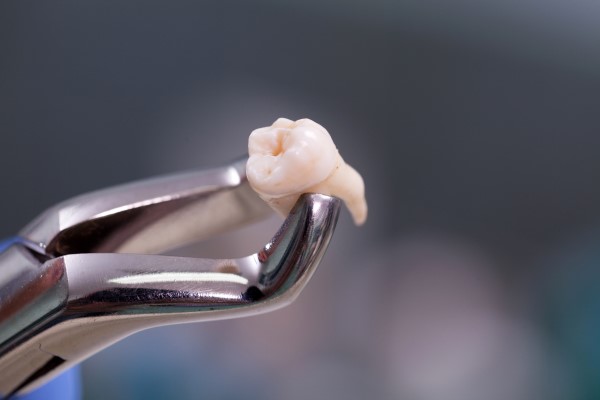 Why You Should Rest After A Tooth Extraction